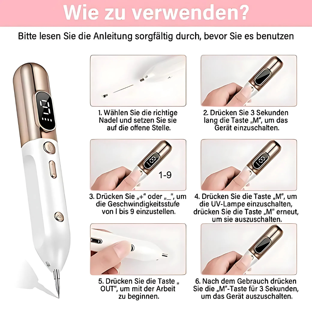 Plasma-Stift zur sicheren Entfernung von Hautmakeln